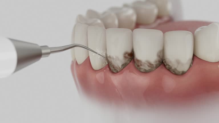 Trusted Emergency Dentist service in Norton, VA - Dentist Open Now